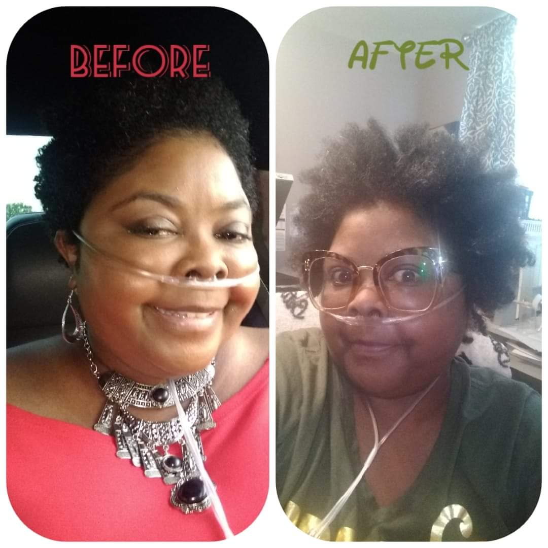 GoGo Grow My Hair Bundle