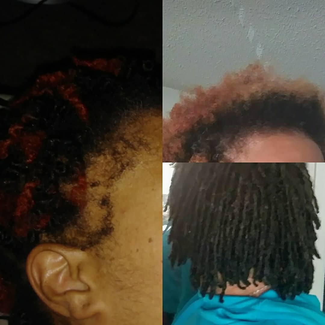 GoGo Grow My Hair Bundle