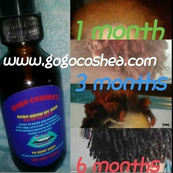 GoGo Grow My Hair Bundle