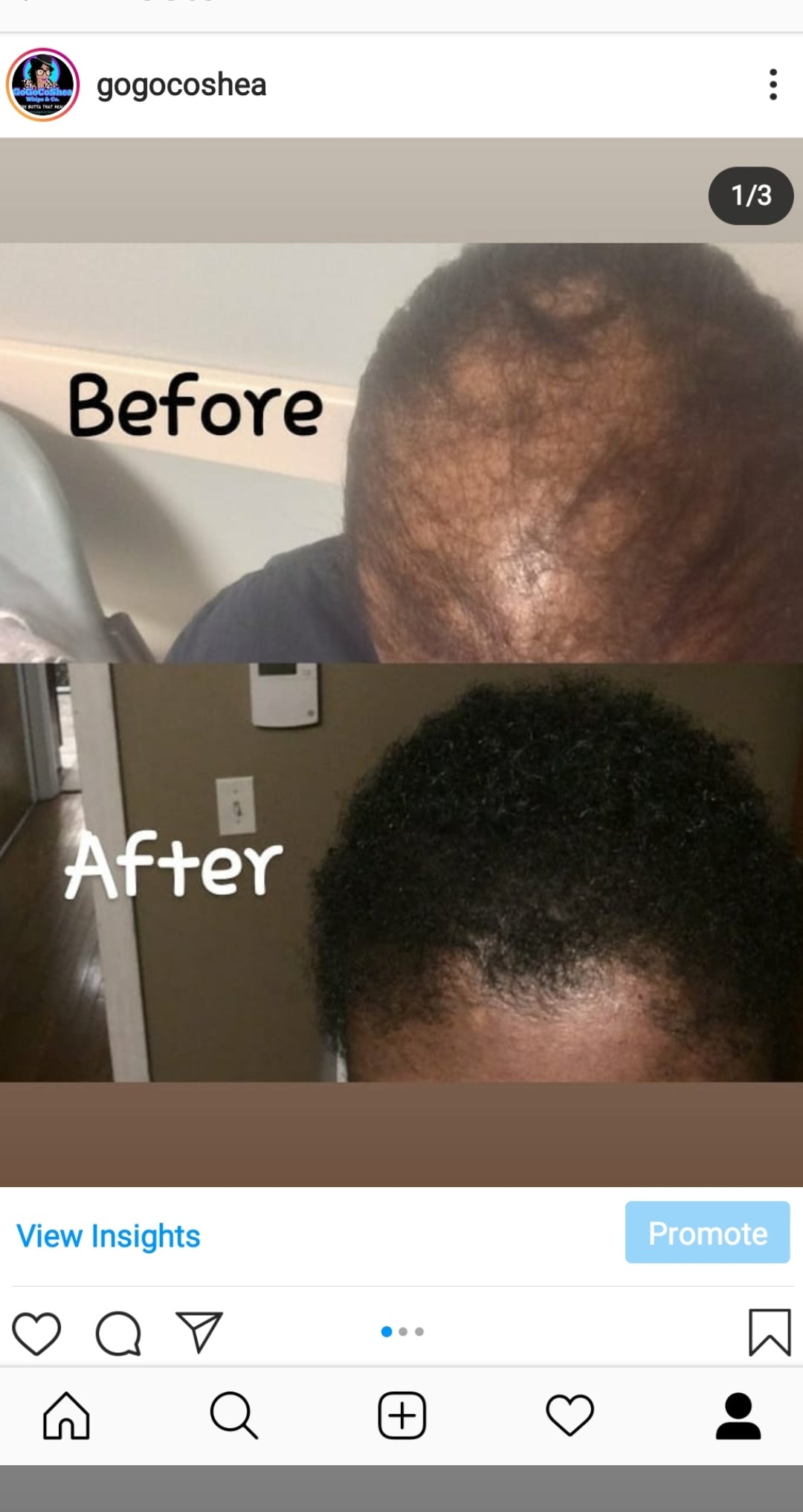 GoGo Grow My Hair Bundle