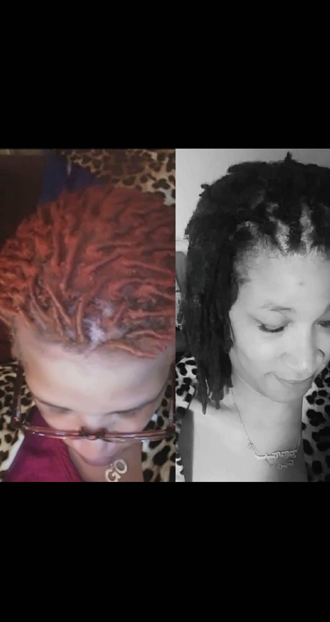Lion's Mane Balding Drops