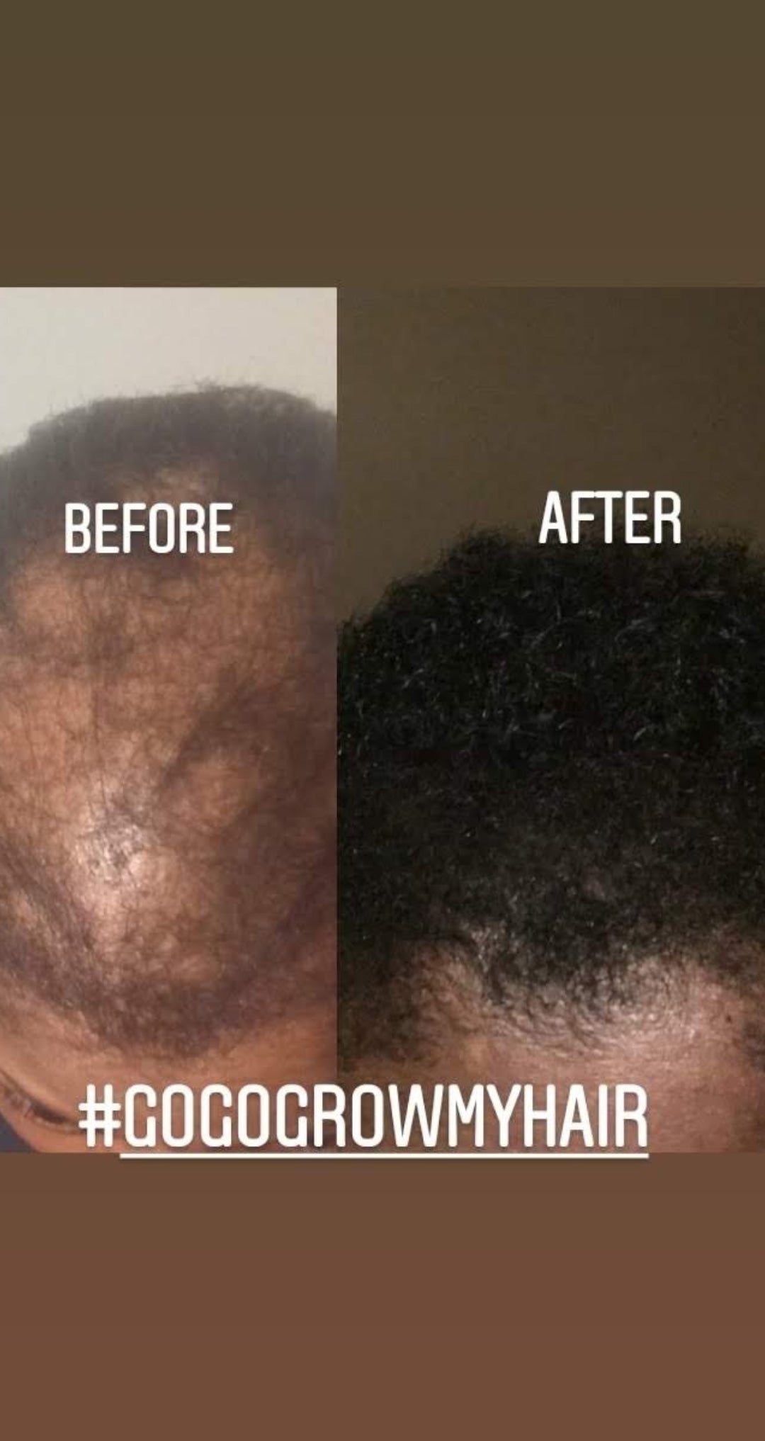 GoGo Grow My Hair Butta